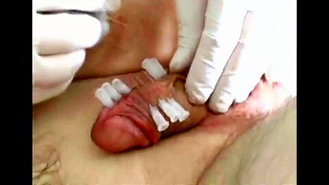 Schwanz nadeln - free porn video