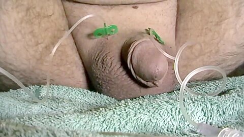 Saline infusion im sack gallon in scrotum - free porn video